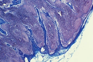 Immune System Cells Drucke: Lymph node, light micrograph C015 / 6223