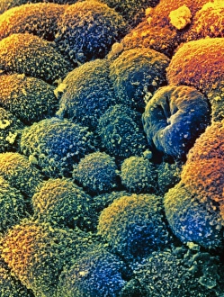 Electron Microscope Images Drucke: m8500351