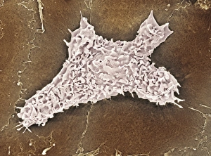 White Blood Cell Structure Drucke: Macrophage cell, SEM