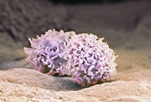 Makrofaugenzellen, SEM