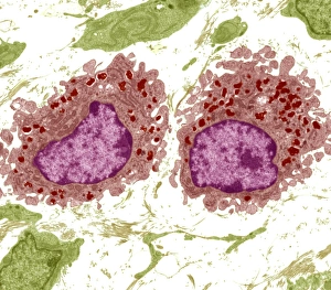 Drucke von Makrofagenzellen, farbiges Transmissionelektronenmikroskopbild (TEM). Die Zellkerne sind violett. Mitochondrien (dunkel rosa ovalförmige Strukturen) im Cytoplasma produzieren Energie für die Zelle Bilder Datiert 2009 Mai: Makrofagzellen, TEM