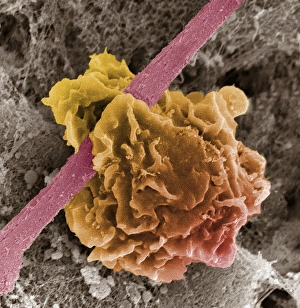 White Blood Cell Biology Drucke: Macrophage ingesting debris, SEM