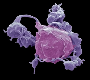 Blood Clot Formation Drucke: Macrophage and platelets, SEM C016 / 3094