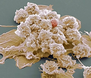 White Blood Cell Structure Drucke: Macrophages, SEM