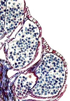 Pollen Grain Morphology Drucke: Male pine cone, light micrograph