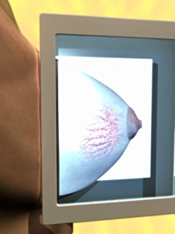 Medical Imaging Technology Drucke: Mammogram, conceptual image