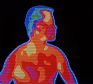 Thermography Images Drucke: Mans thermogram