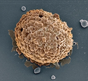 Scanning Electron Microscope Images Drucke: Mast cell, SEM