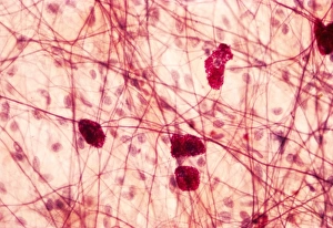 White Blood Cell Types Drucke: Mast cells, light micrograph