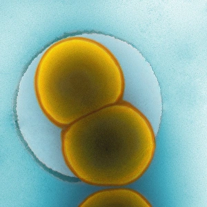 Coloured TEM Images Drucke: Meningitis C bacteria, TEM