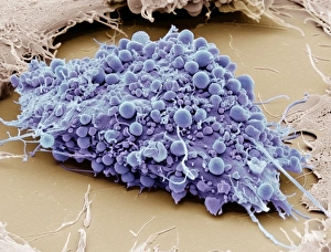 Mesenchymaler Stammzellen (SEM)
