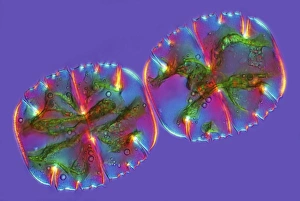 Polarised Light Microscopy Drucke: Micrasterias desmids, light micrograph