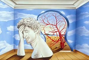 Migraine Symptoms Drucke: Migraine