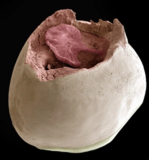 Milchzahn, SEM