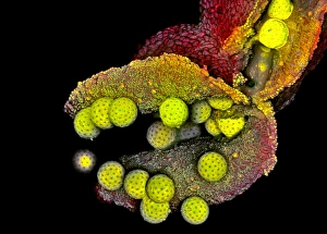 Light Microscopy Images Drucke: Mirabilis anther, light micrograph
