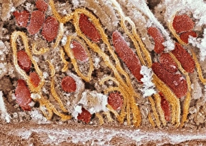 Mitochondrien, SEM