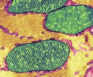 Mitosomium, TEM