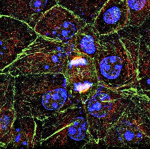 Cell Division Drucke: Mitosis, fluorescence micrograph