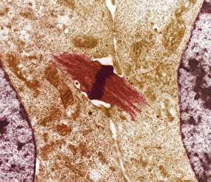 Transmission Electron Micrograph TEM Drucke: Mitotic cell division, TEM