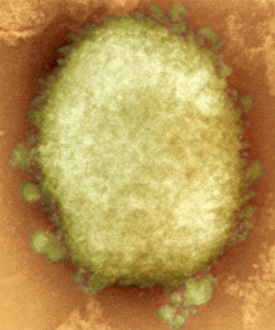 Coloured TEM Images Drucke: Monkeypox virus particle, TEM