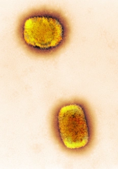 Coloured TEM Images Drucke: Monkeypox virus particles, TEM C016 / 7384