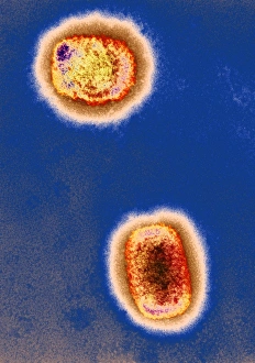 Monkeypox Virus Drucke: Monkeypox virus particles, TEM C016 / 7386