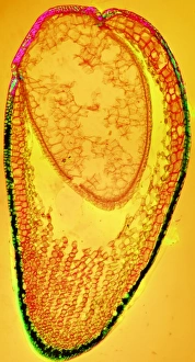 Polarised Light Micrograph Drucke: Moss spore capsule, light micrograph
