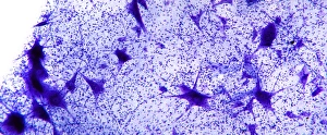 Nerve Cell Structure Drucke: Motor neurones, light micrograph