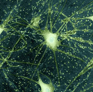 Central Nervous System Cells Drucke: Motor neurons, light micrograph