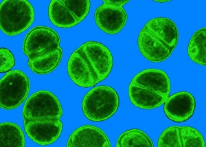 MRSA Bacteria Drucke: MRSA bacteria