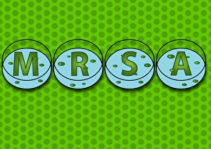 Drucke von MRSA ist eine gram-positivee Rundbakterie (Coccus), die gegen viele häufig verschriebene Antibiotika resistent ist und sich in etwa 30% der Bevölkerung ohne Symptome im Körper befindet Bilder Datiert 2005 Oktober: MRSA