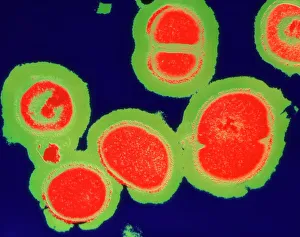 Bilder, datiert 1995: Resistenz gegen MRSA-ähnliche Staphylokokkenbakterien