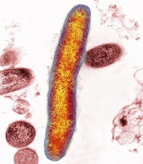 Transmission Electron Micrograph TEM Drucke: Mycobacterium bacteria, TEM