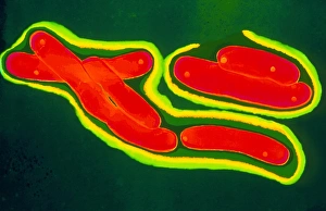 Mycobacterium Tuberculosis Drucke: Mycobacterium tuberculosis bacteria