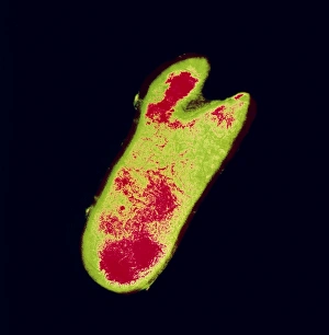 Mycobacterium Tuberculosis Bacteria Drucke: Mycobacterium tuberculosis bacterium