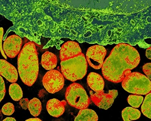 Coloured Electron Micrograph Drucke: Mycoplasma bacteria, TEM