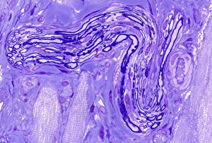 Schwann Cell Function Drucke: Myelinated nerve, light micrograph