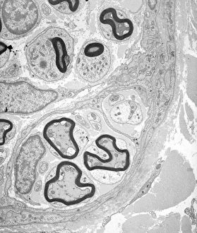 Schwann Cell Function Drucke: Myelinated nerve tissue, TEM