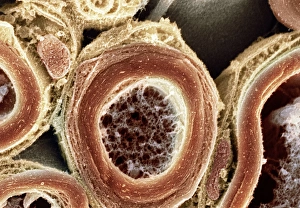 Myelinated Nerve Fibres Drucke: Myelinated nerves, SEM