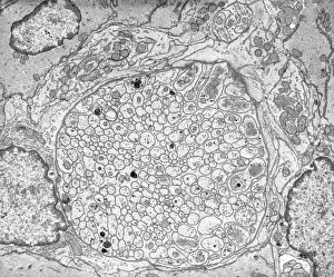 Transmission Electron Micrograph TEM Drucke: Myenteric nerve plexus, TEM