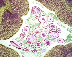 Light Microscopy Images Drucke: Nematode infection, light micrograph