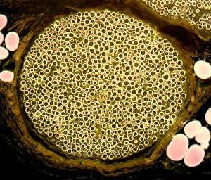 Myelin Sheath Structure Drucke: Nerve bundle, light micrograph