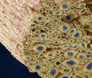 Myelinated Nerve Fibres Drucke: Nerve bundle, SEM