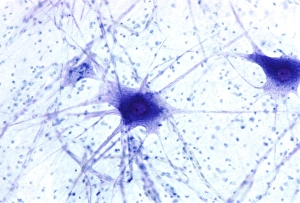 Nerve Cells Drucke: Nerve cells, light micrograph