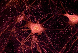 Drucke von Nervenzellen oder Neuronen, Lichtmikroskopie. Nervenzellen sind für die Weitergabe von Informationen im Zentralnervensystem (ZNS) und vom ZNS zum Rest des Körpers verantwortlich Bilder Datiert 2008 Juli: Nervenzellen im Lichtmikroskop