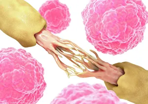 Stem Cell Research Drucke: Nerve damage and stem cells, artwork