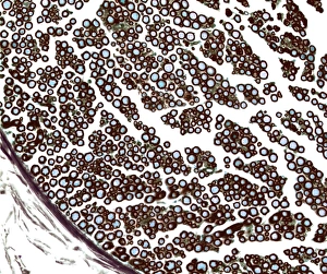Myelinated Nerve Fibres Drucke: Nerve fibres, light micrograph