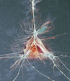 Myelin Sheath Formation Drucke: Nerve support cell, SEM