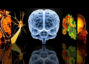 Neurology Images Drucke: Neurology