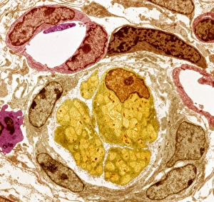 Drucke von Nerven- und Blutgefäßbundel. Farbenmikroskopische Aufnahme (TEM) einer Schnittstelle durch ein Nerven- und Blutgefäßbundel (NVB) Bilder Datiert 2007 Juli: Nerven- und Blutgefäßbundel, TEM